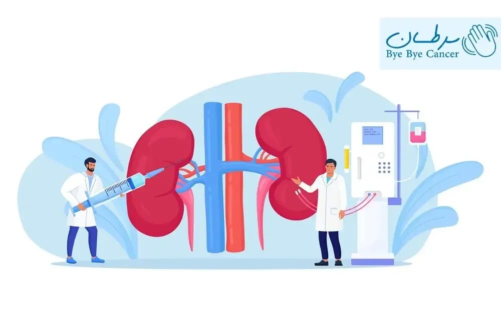 سرطان کلیه