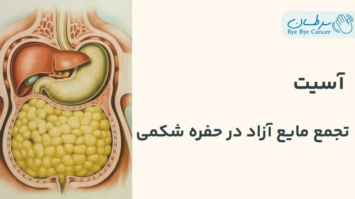 آسیت