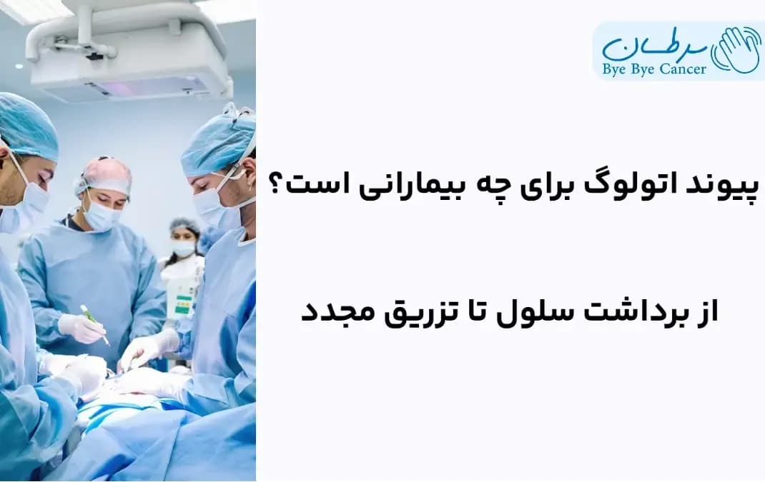 پیوند اتولوگ
