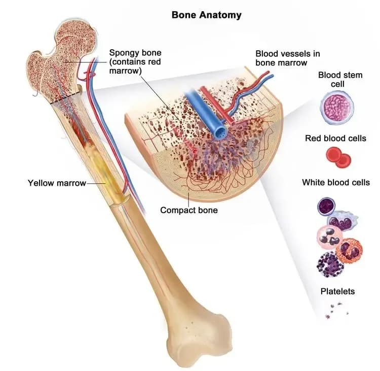 CML-leukemia.webp