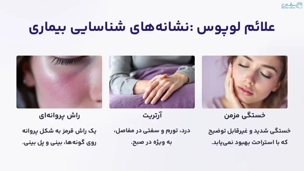 Lupus-symptoms-1024x576.webp