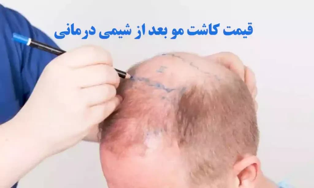 PTsc73bsKWTekQvFsVI4Hdawu3aUypxZRWAD0e9Z-1024x614.webp