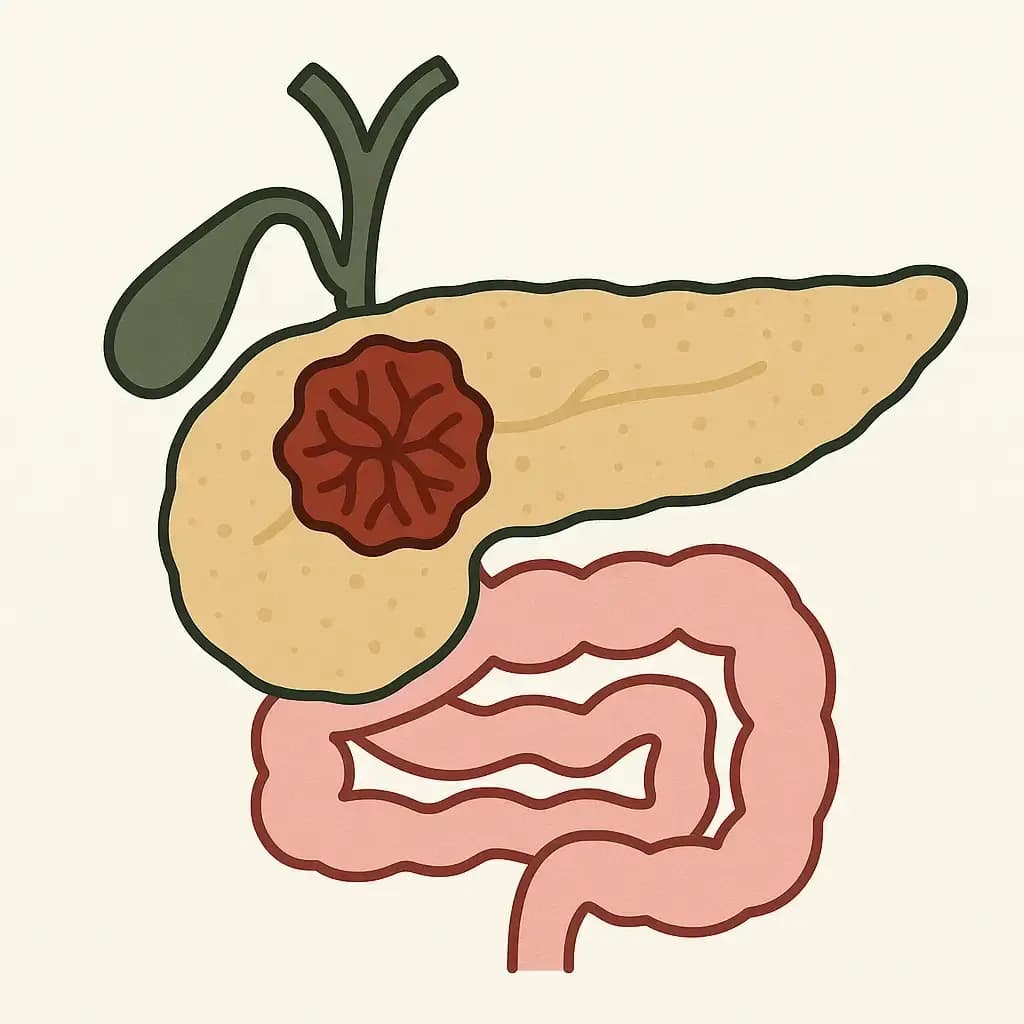 Pancreatic-cancer.12.webp
