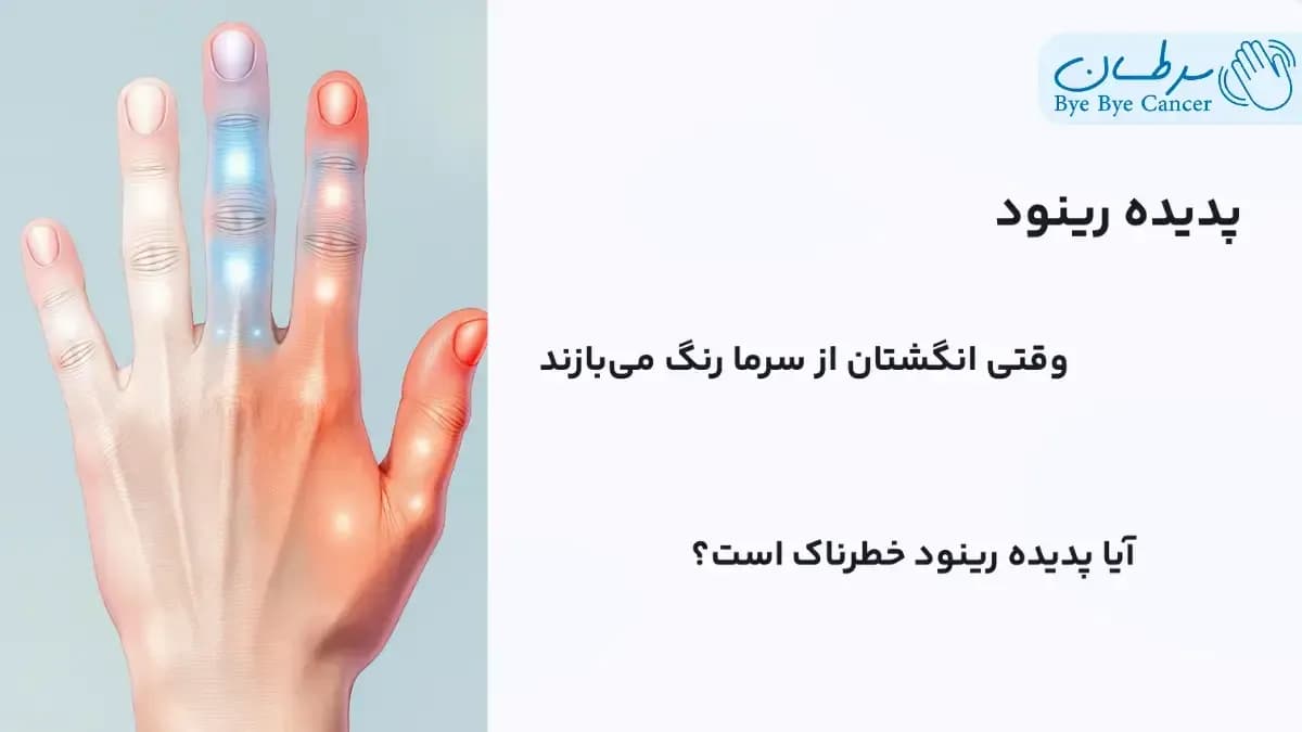 پدیده رینود