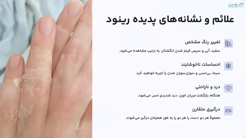 Signs-and-symptoms-of-Raynauds-phenomenon-1024x576.webp