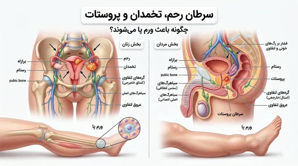 Swelling.2-1024x572.webp