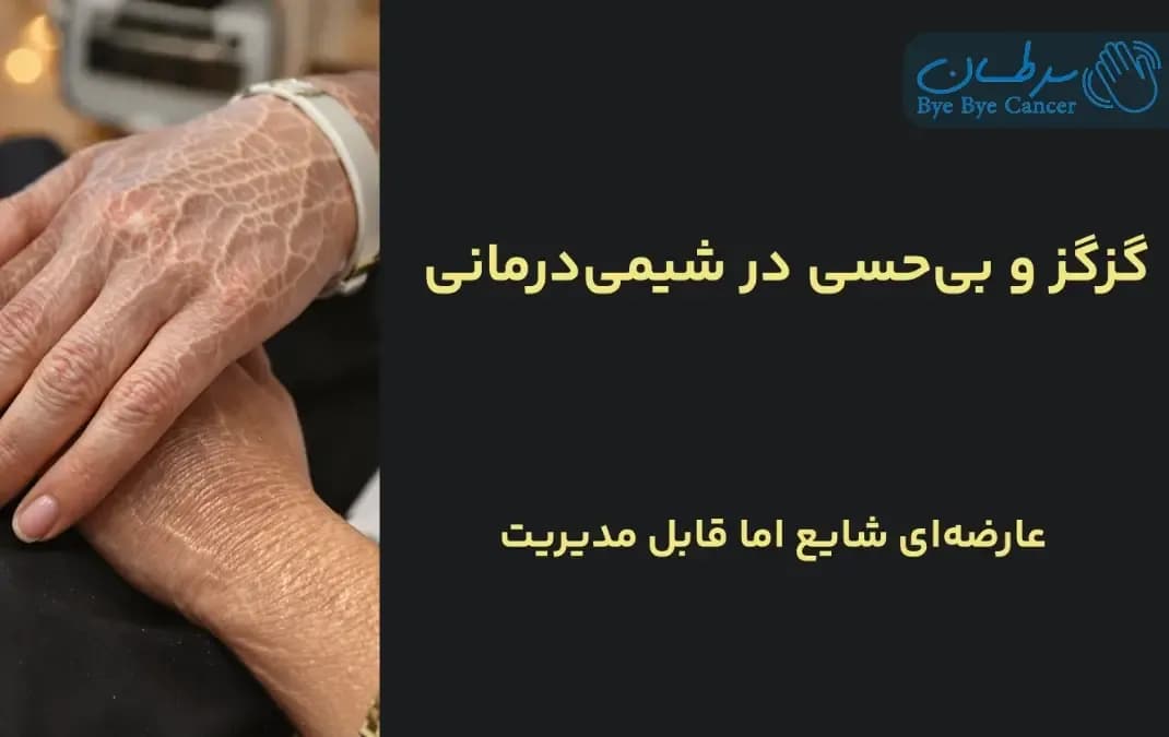 گز گز دست و پا در حین شیمی درمانی