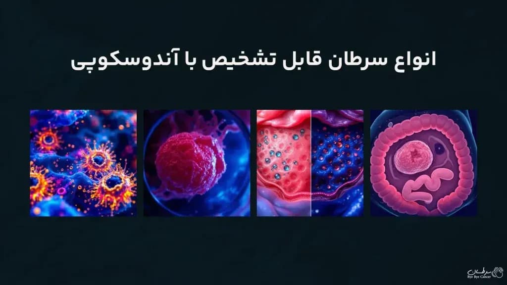 Types-of-cancer-that-can-be-diagnosed-with-endoscopy-1024x576.webp