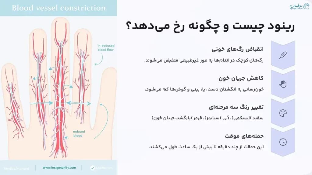 What-is-Raynauds-and-how-does-it-occur-1024x576.webp