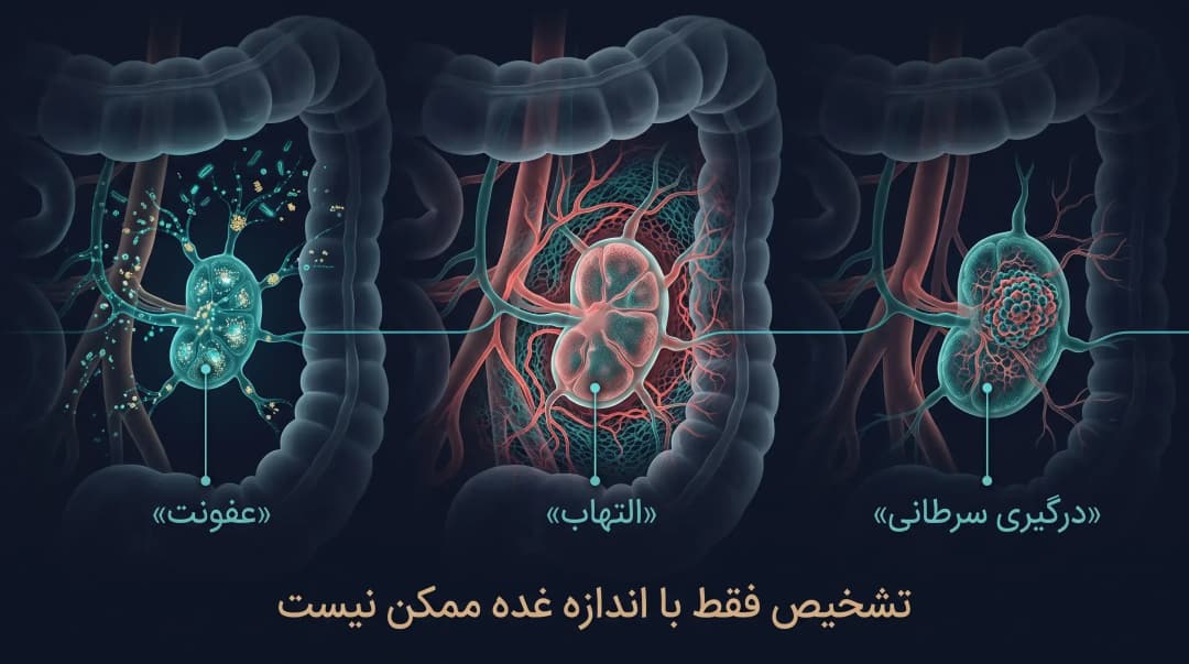 غدد لنفاوی شکم
