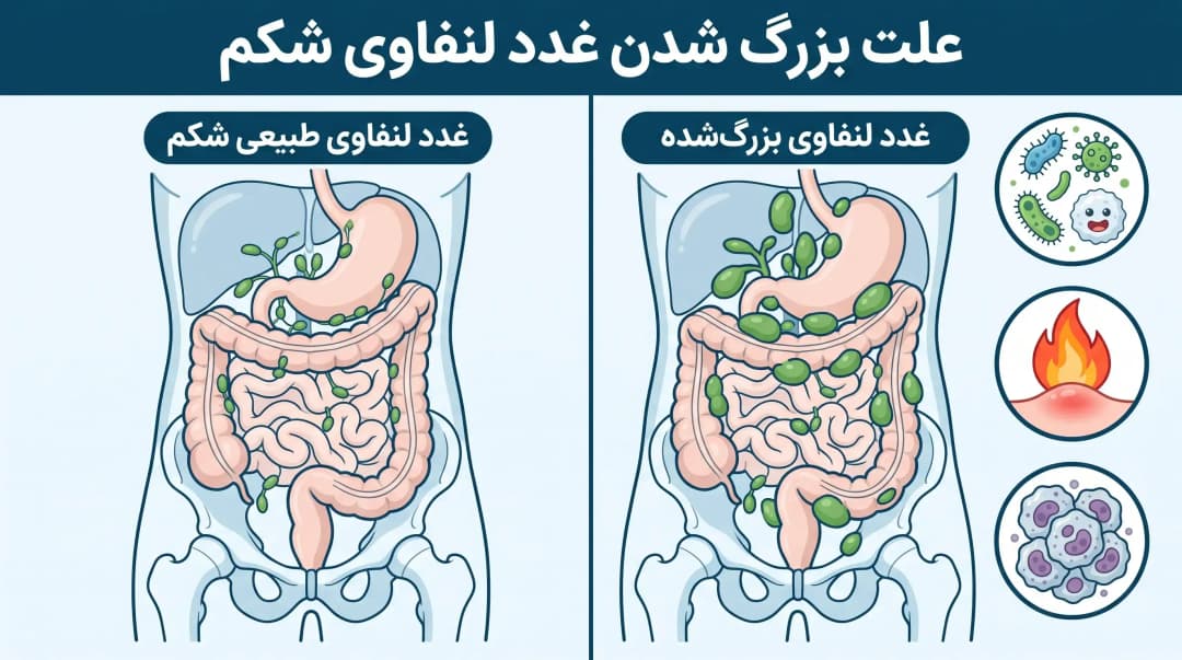 غدد لنفاوی شکم کجاست