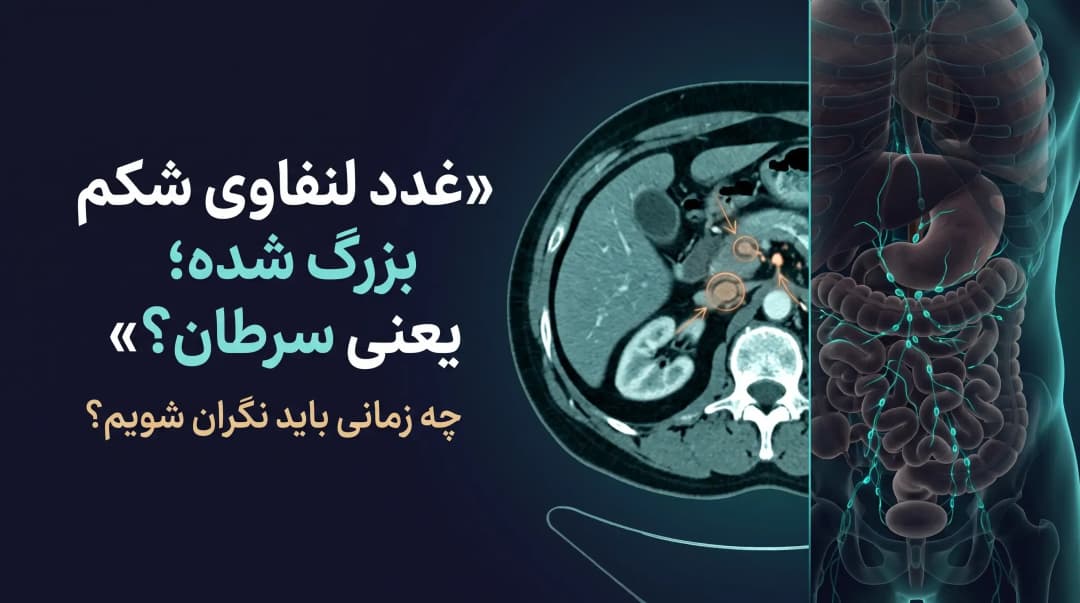 غدد لنفاوی شکم