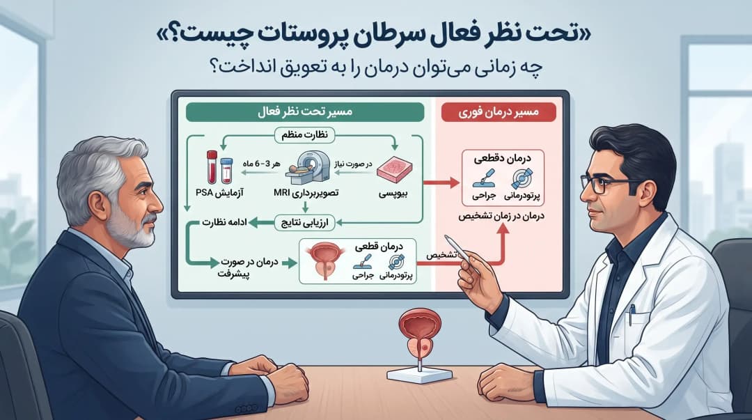 تحت نظر فعال سرطان پروستات