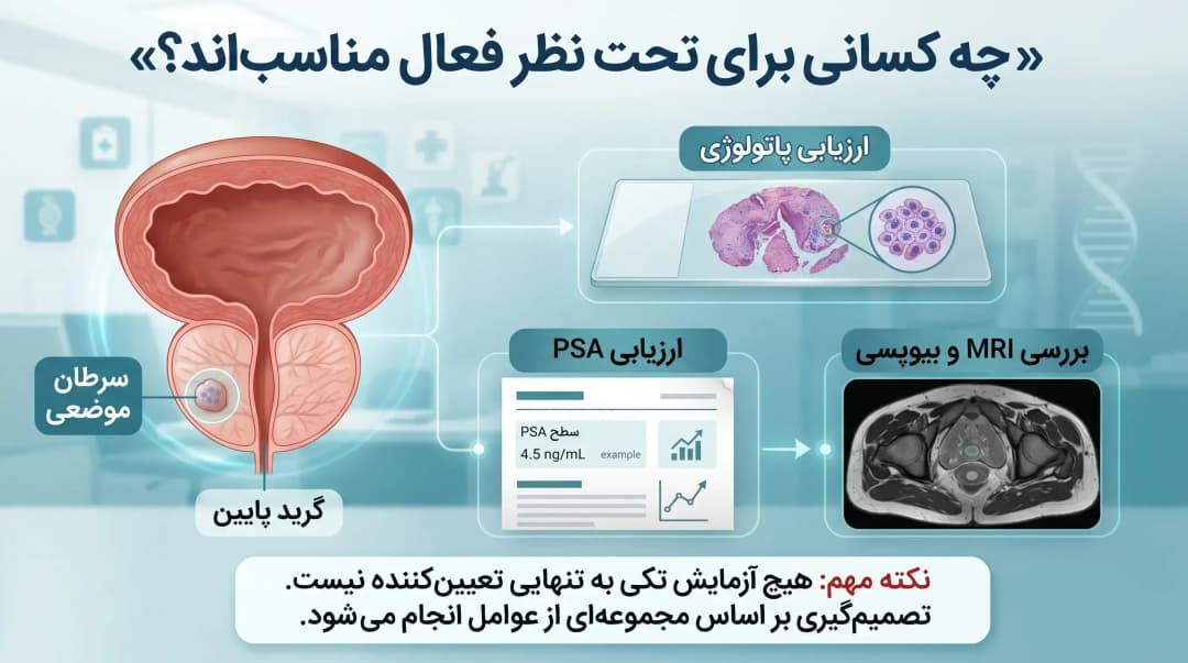تحت نظر فعال سرطان پروستات