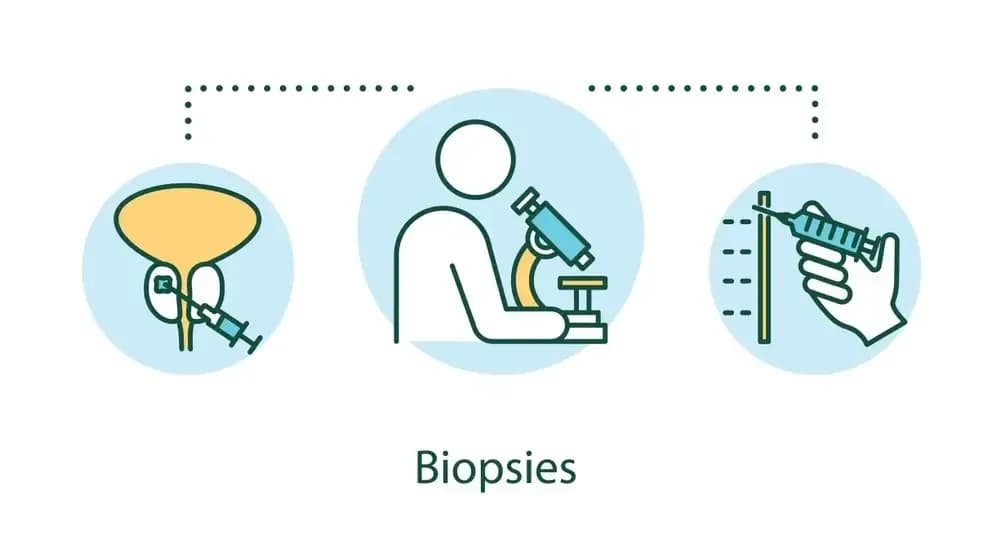 biopsy-and-pathology.1.webp