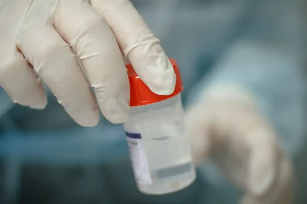 biopsy.webp