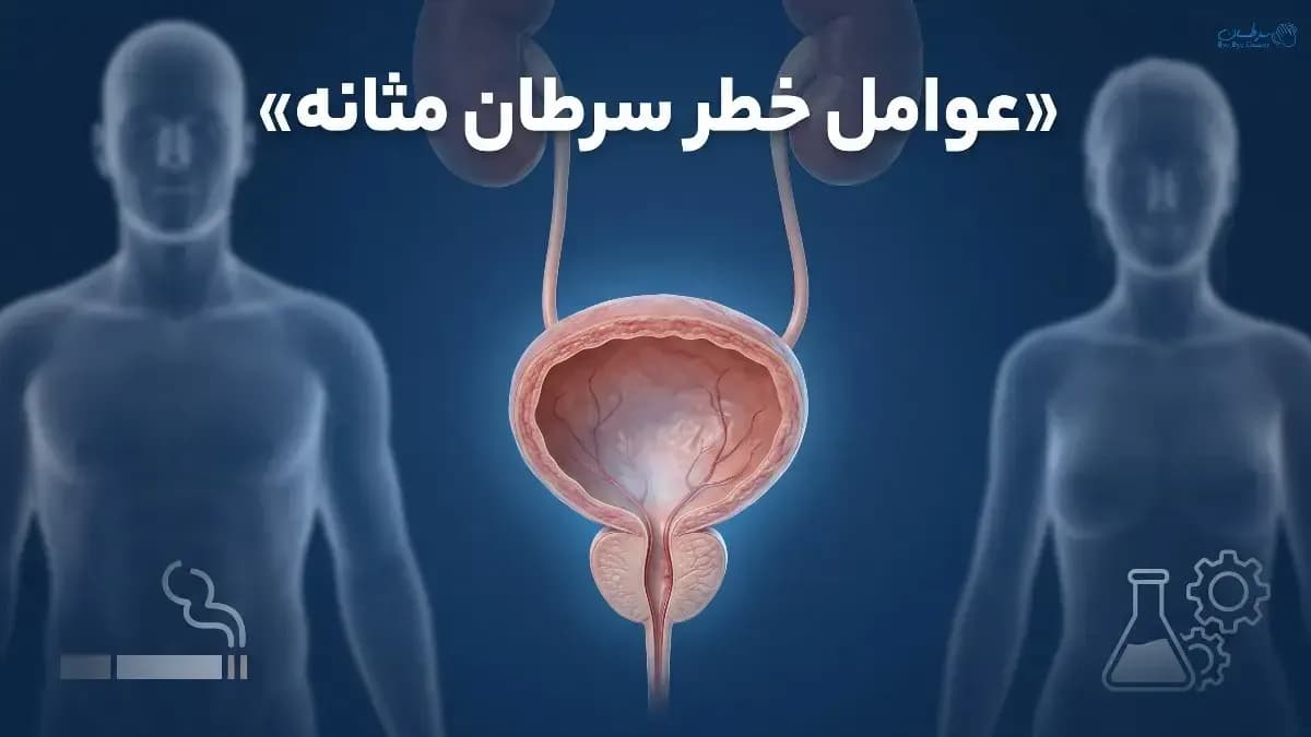 عوامل خطر سرطان مثانه