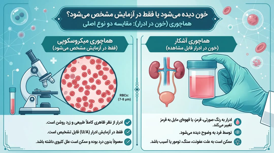 خون در ادرار (هماچوری)