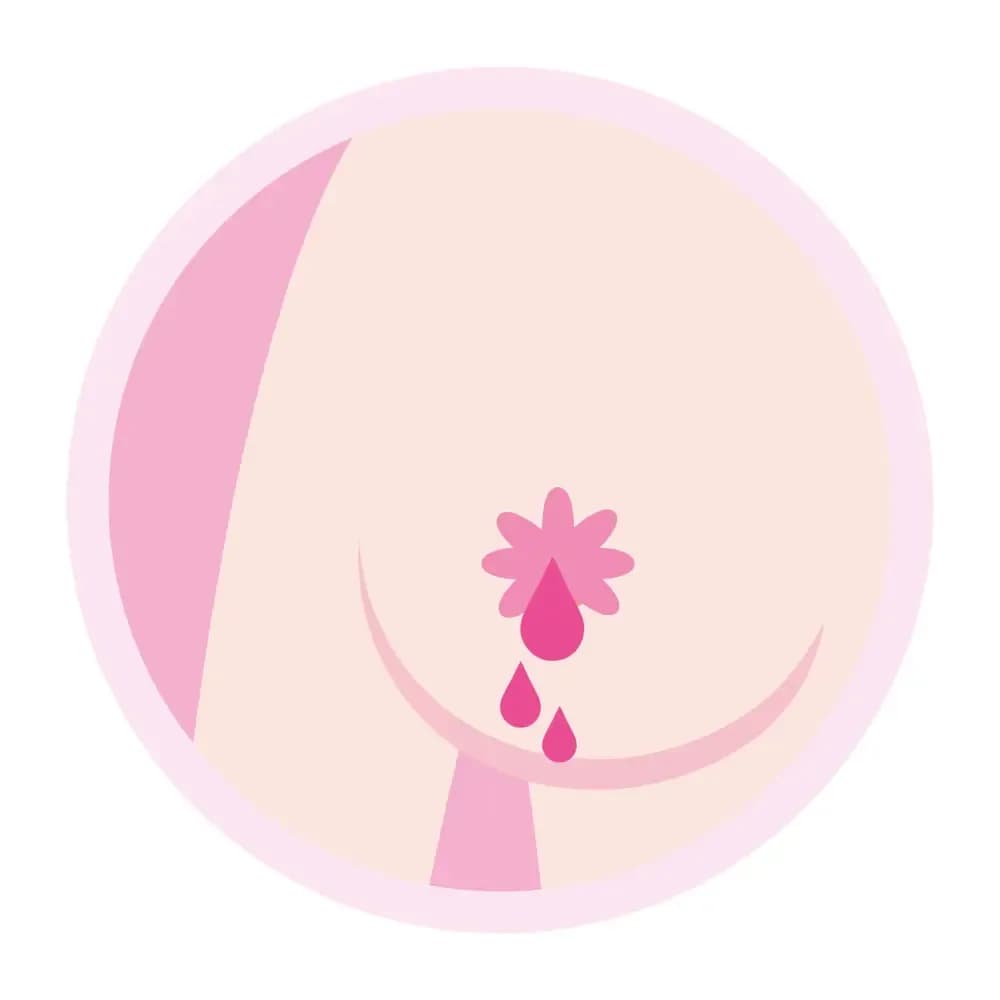 bloody-discharge-from-the-nipple.1.webp