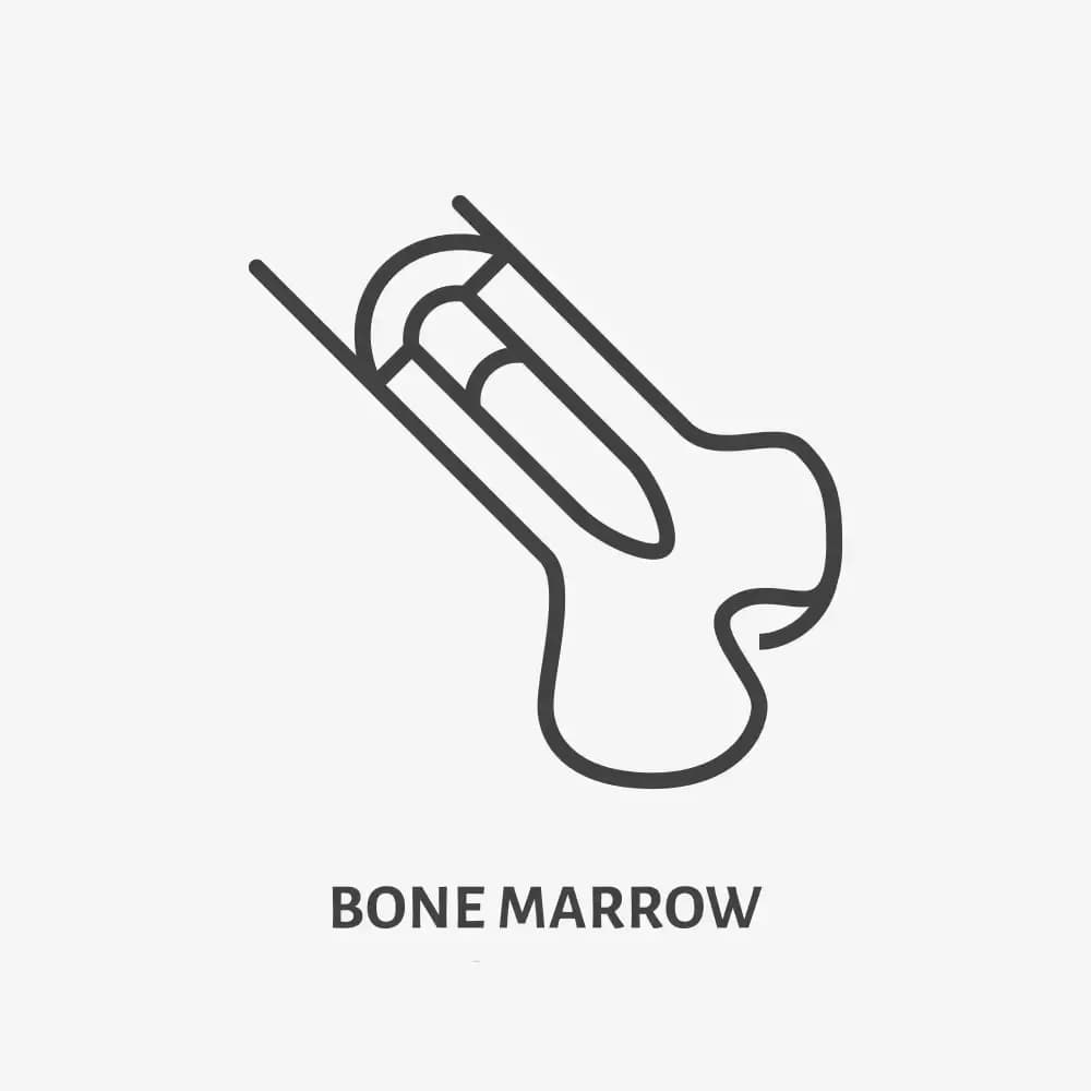 bone-biopsy.1.webp