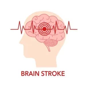 brain-stroke-300x300.webp