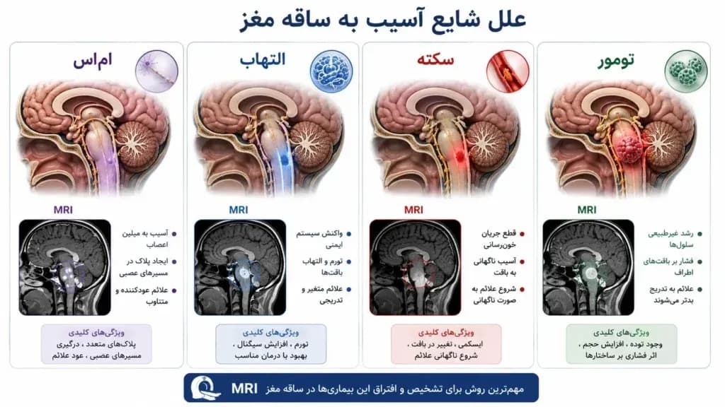 brainstem.3-1024x576.webp