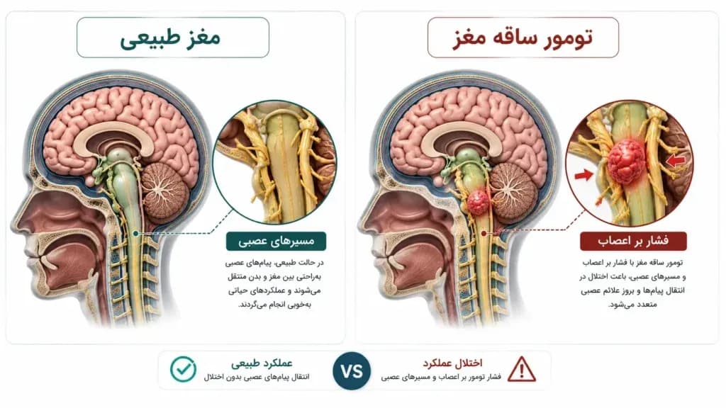 brainstem.7-1024x576.webp