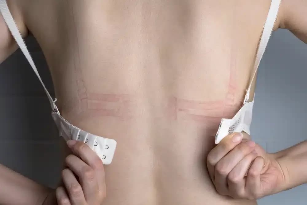 breast-and-bra-cancer.1.webp