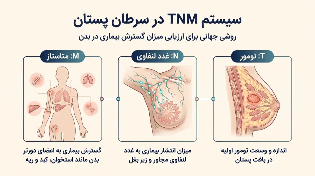 شناخت مراحل سرطان پستان