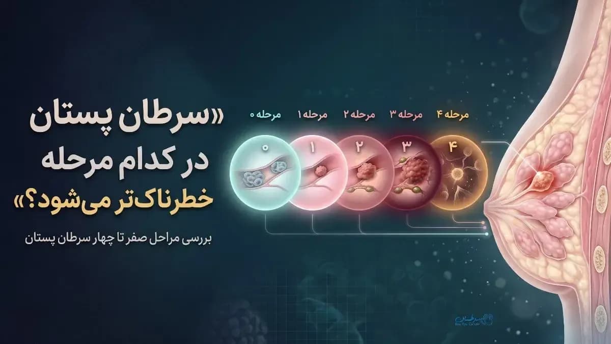 شناخت مراحل سرطان پستان
