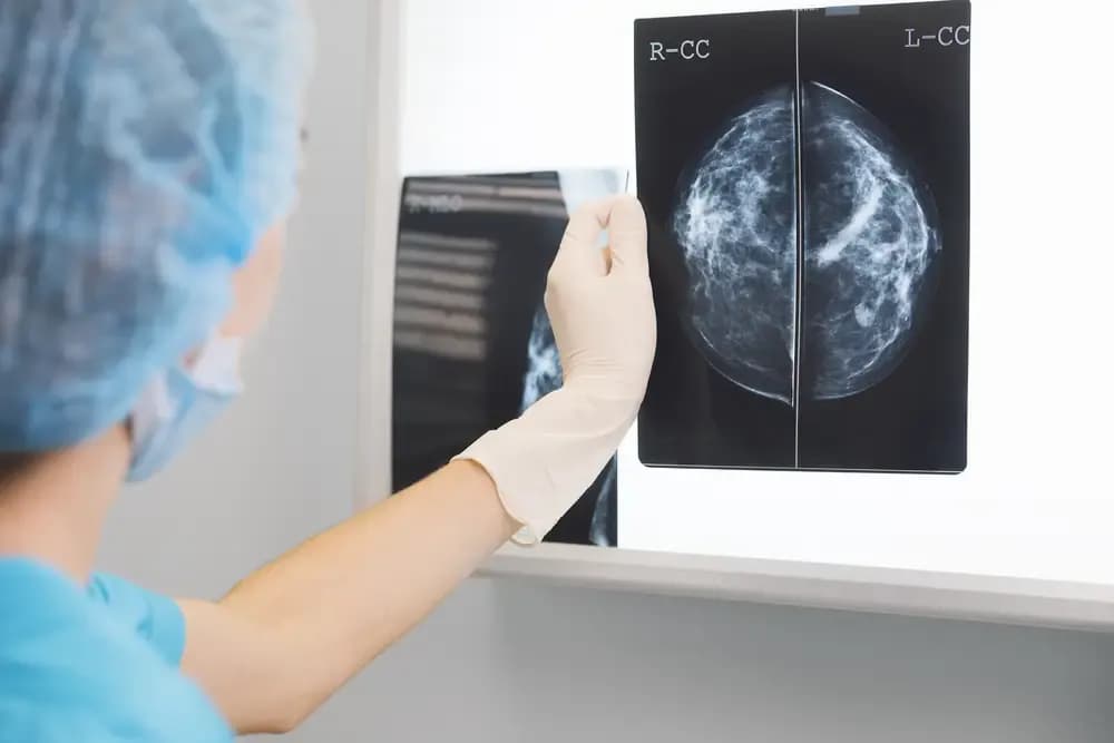 breast-cancer-surgeon.webp