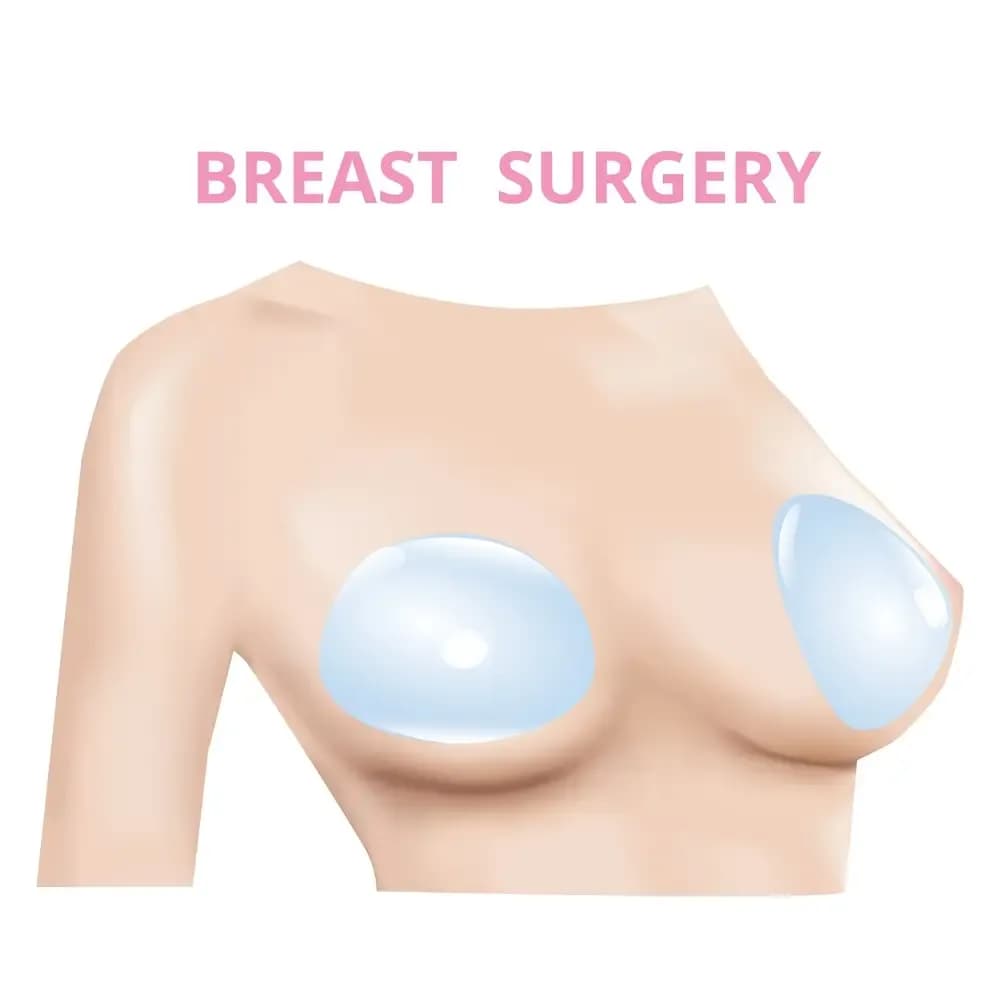 breast-cancer-surgery.1.webp