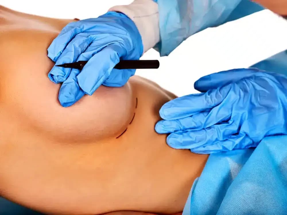 breast-liposuction.1.webp