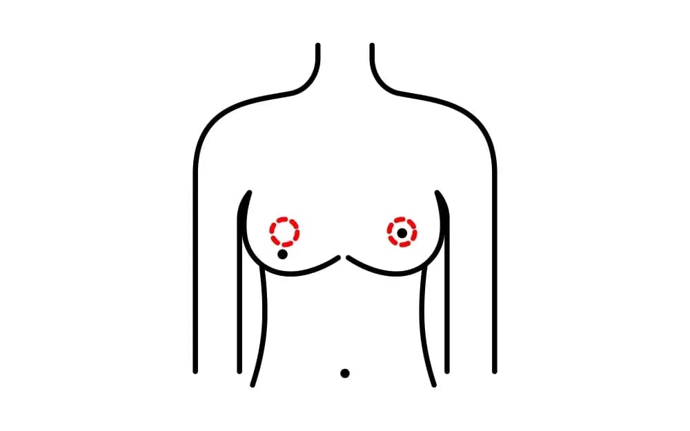 breast-reconstruction-edited.webp
