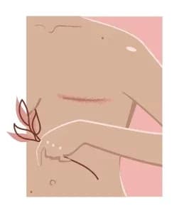 breast-reconstruction.1-266x300.webp