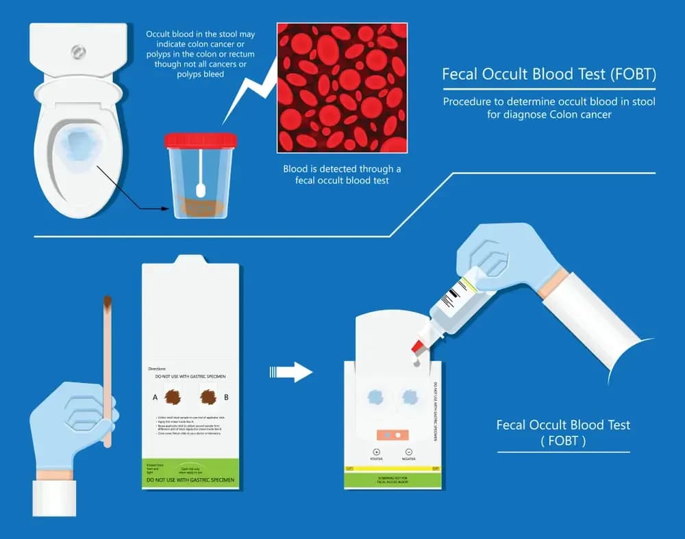 buy-colon-cancer-diagnosis-kit.webp
