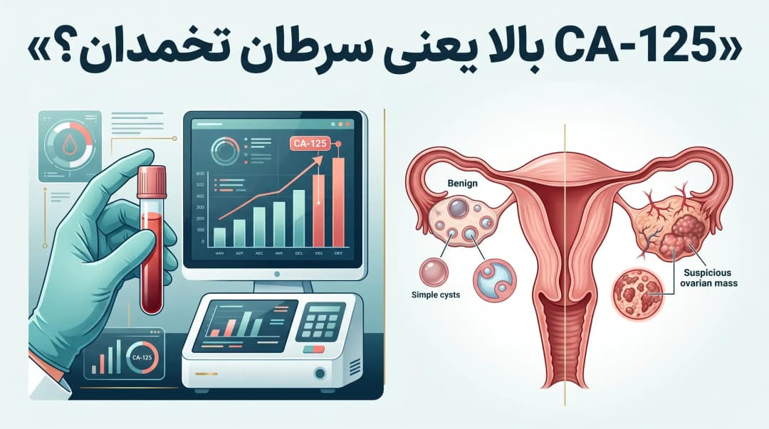 CA-125 و سرطان تخمدان