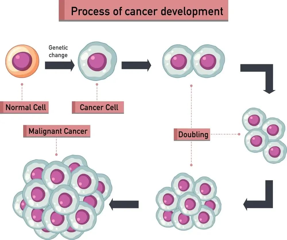 cancer-grading.webp