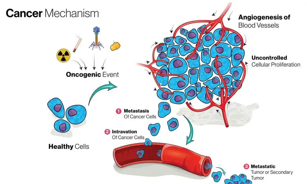 cancer-stage.webp