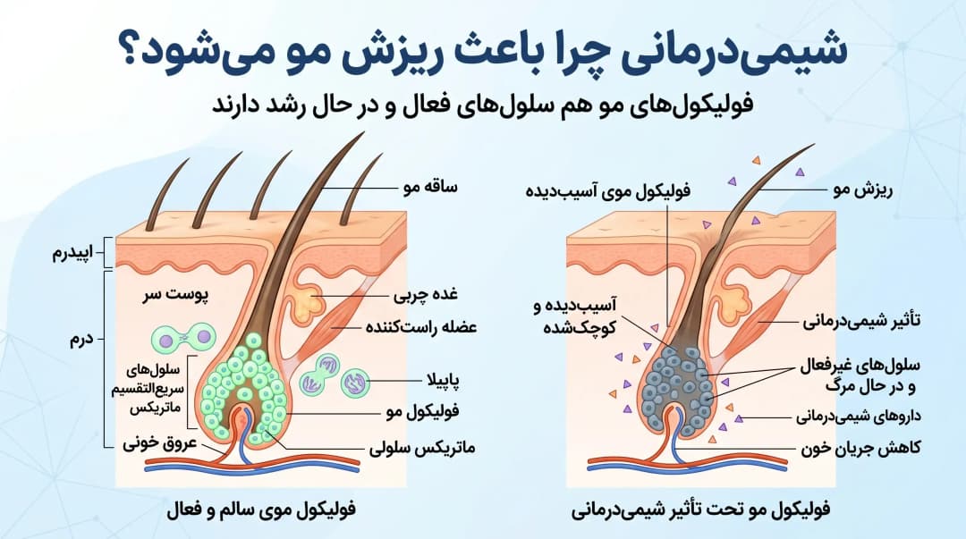 نریختن مو در شیمی درمانی