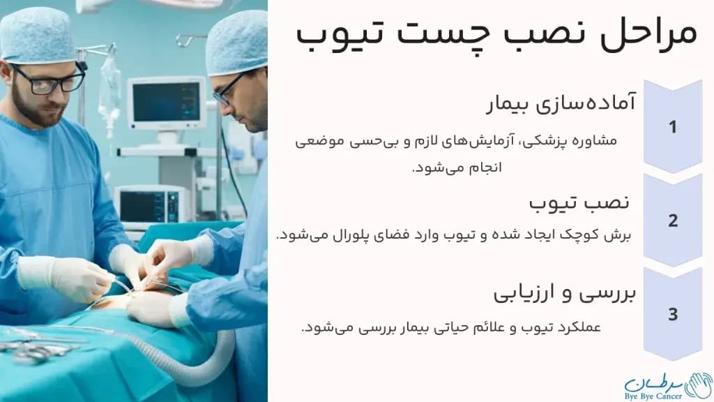 chest-tube.4-1024x576.webp