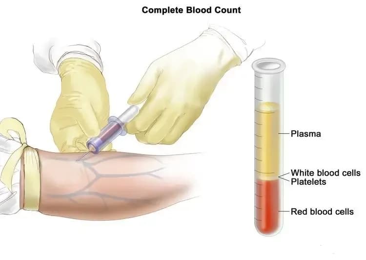 chronic-myelogenous-leukemia.1.webp