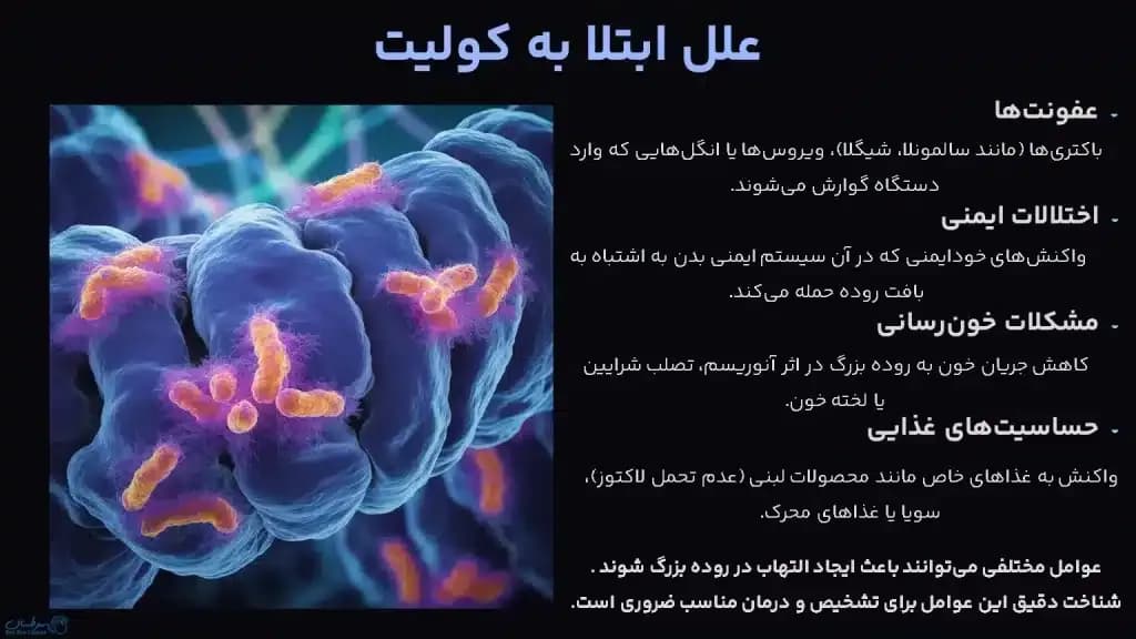 colitis.2-1024x576.webp