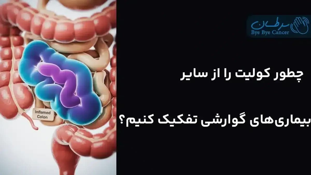 بیماری کولیت