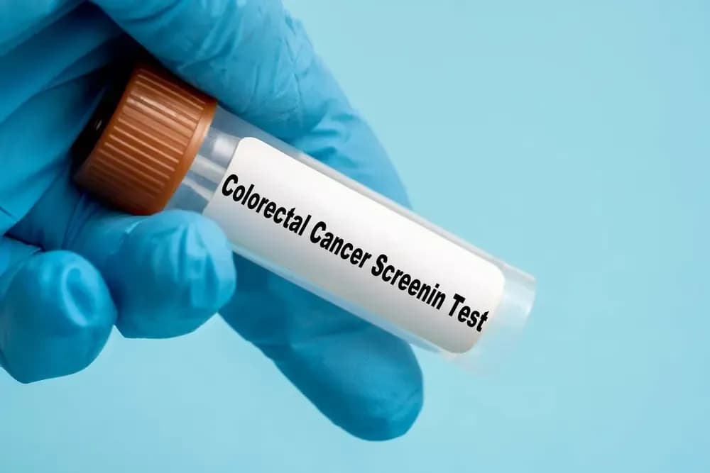 colon-cancer-screening.webp