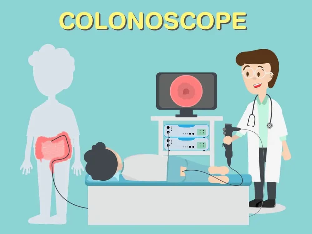 colonoscopy.webp
