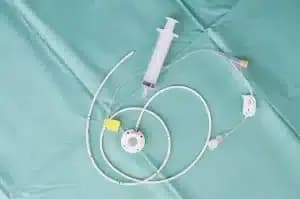 complications-of-porting-chemotherapy-300x199.webp