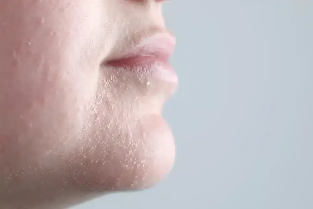dermatology-challenges-of-cancer-treatment.webp