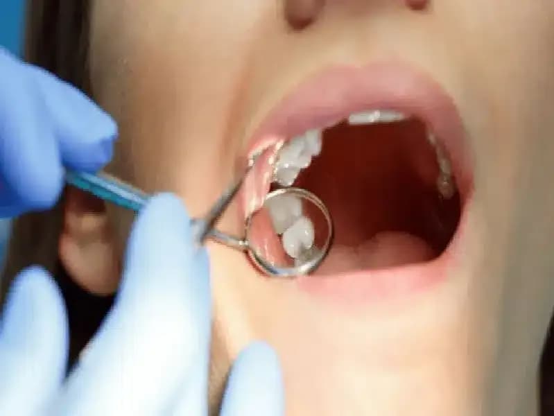 diagnosis-of-oral-cancer.2.webp
