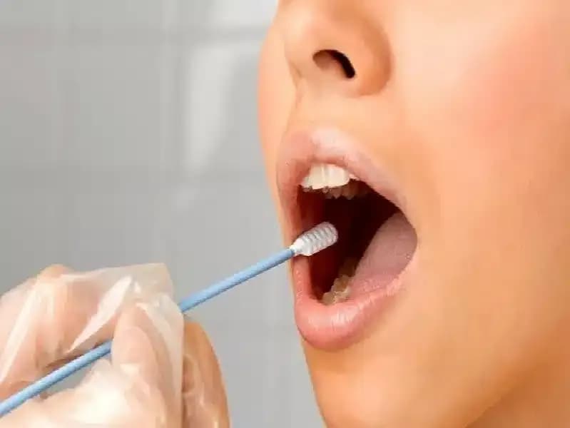 diagnosis-of-oral-cancer.3.webp